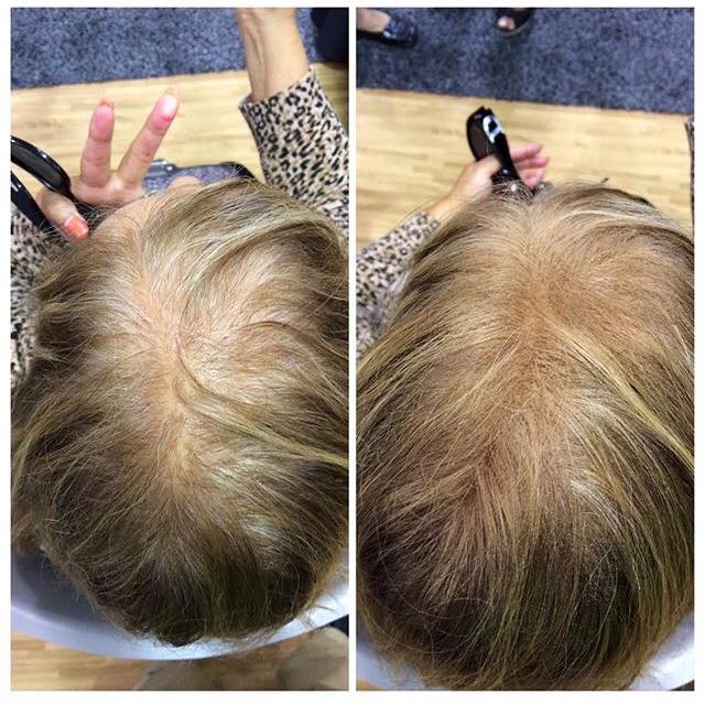 Before and After