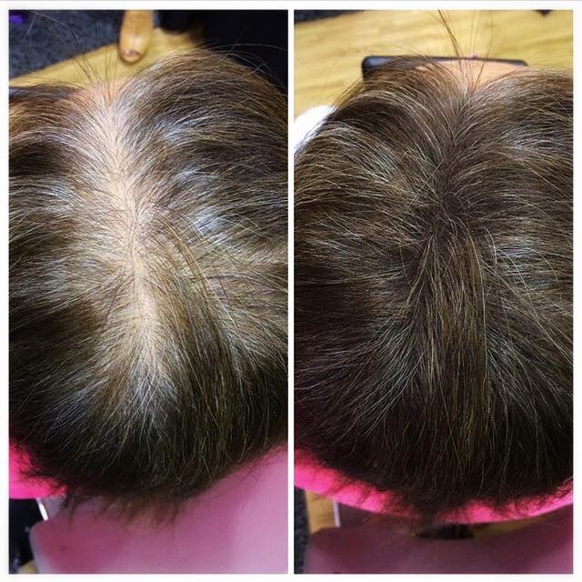 Before and After