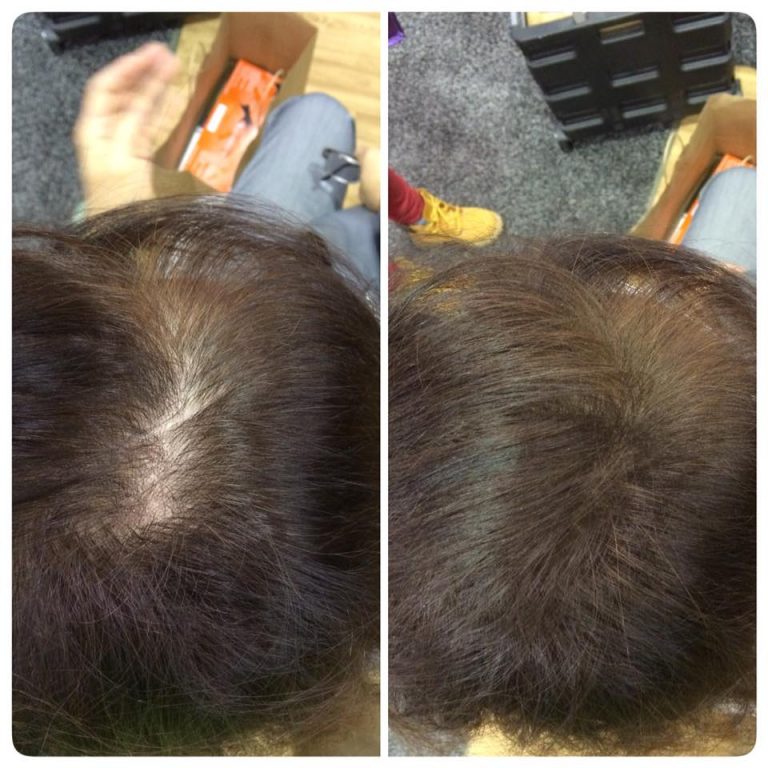 Before and After