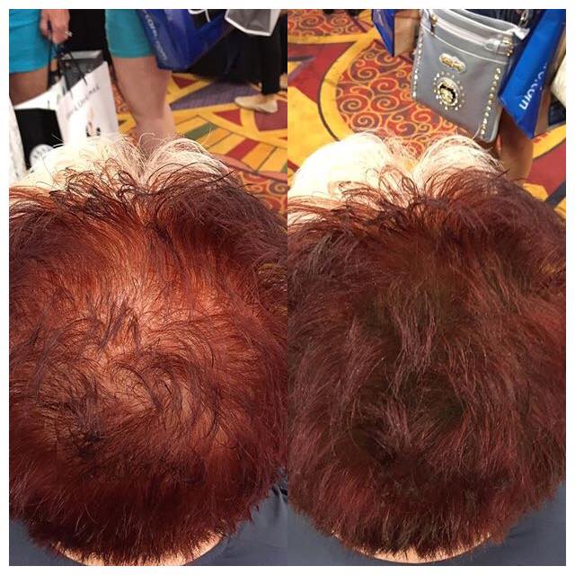 Before and After