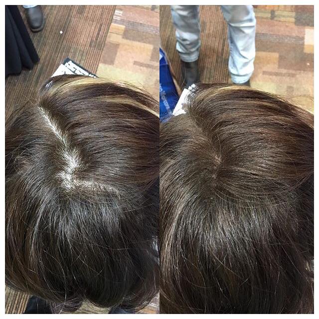 Before and After