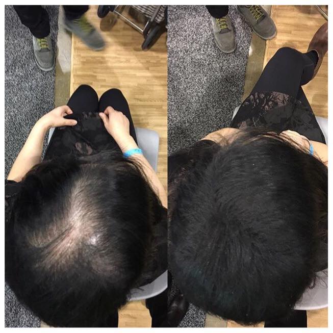 Before and After