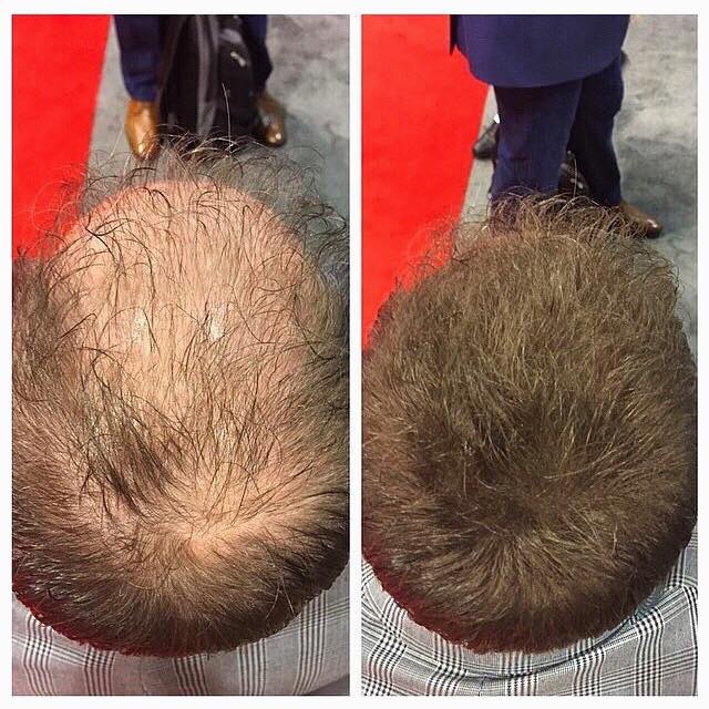 Before and After