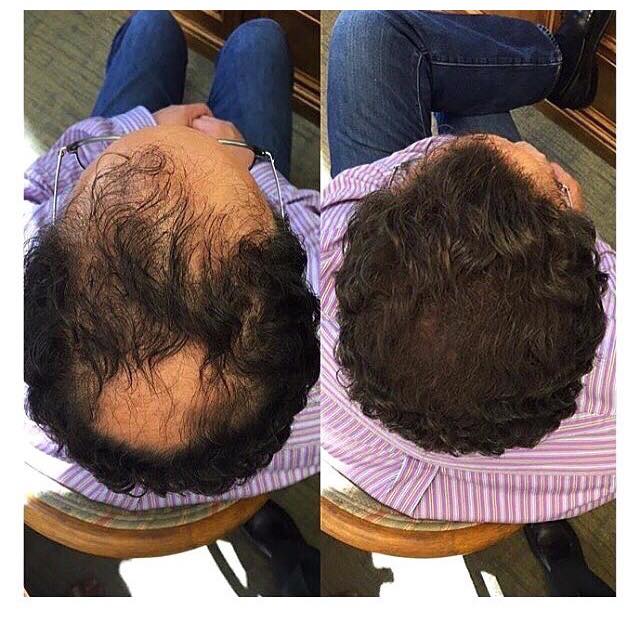 Before and After