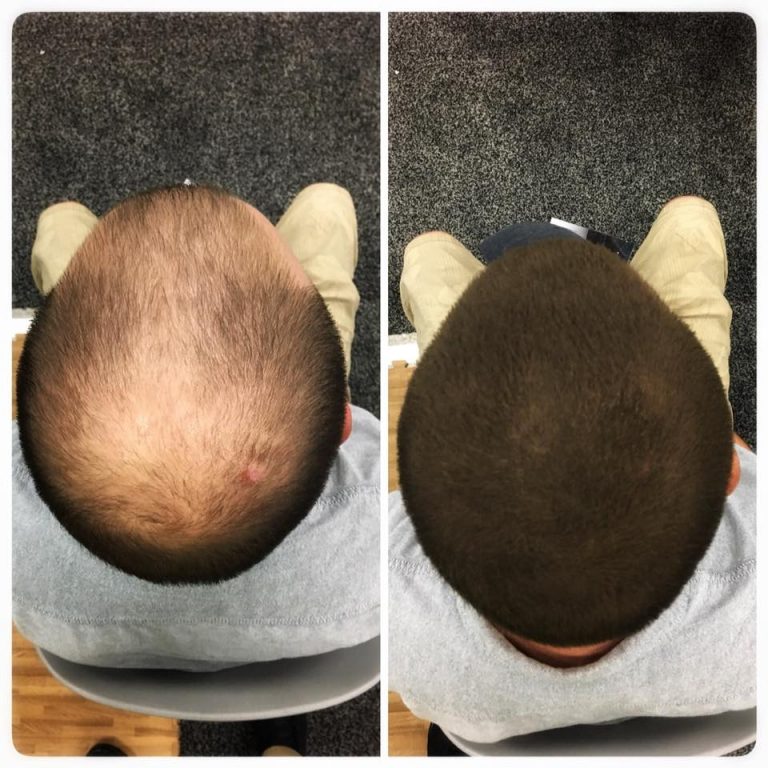Before and After