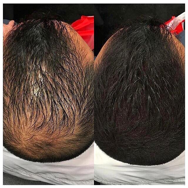 Before and After