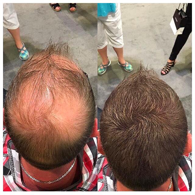 Before and After