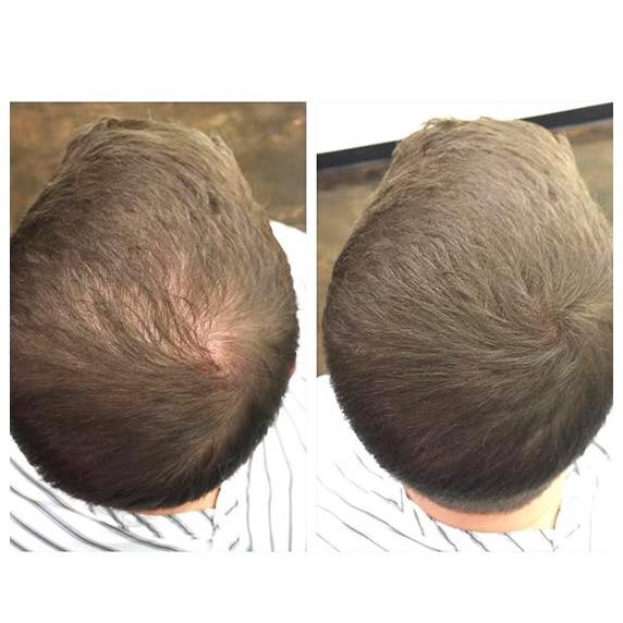 Before and After