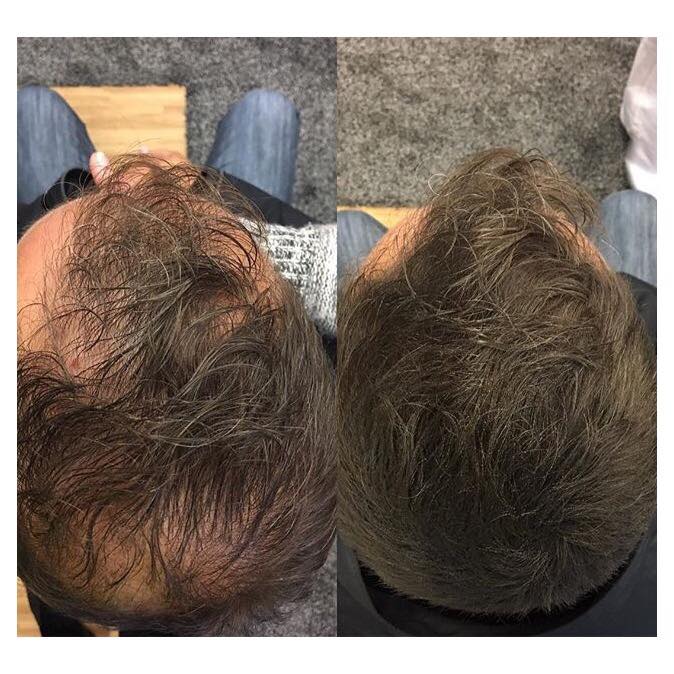Before and After
